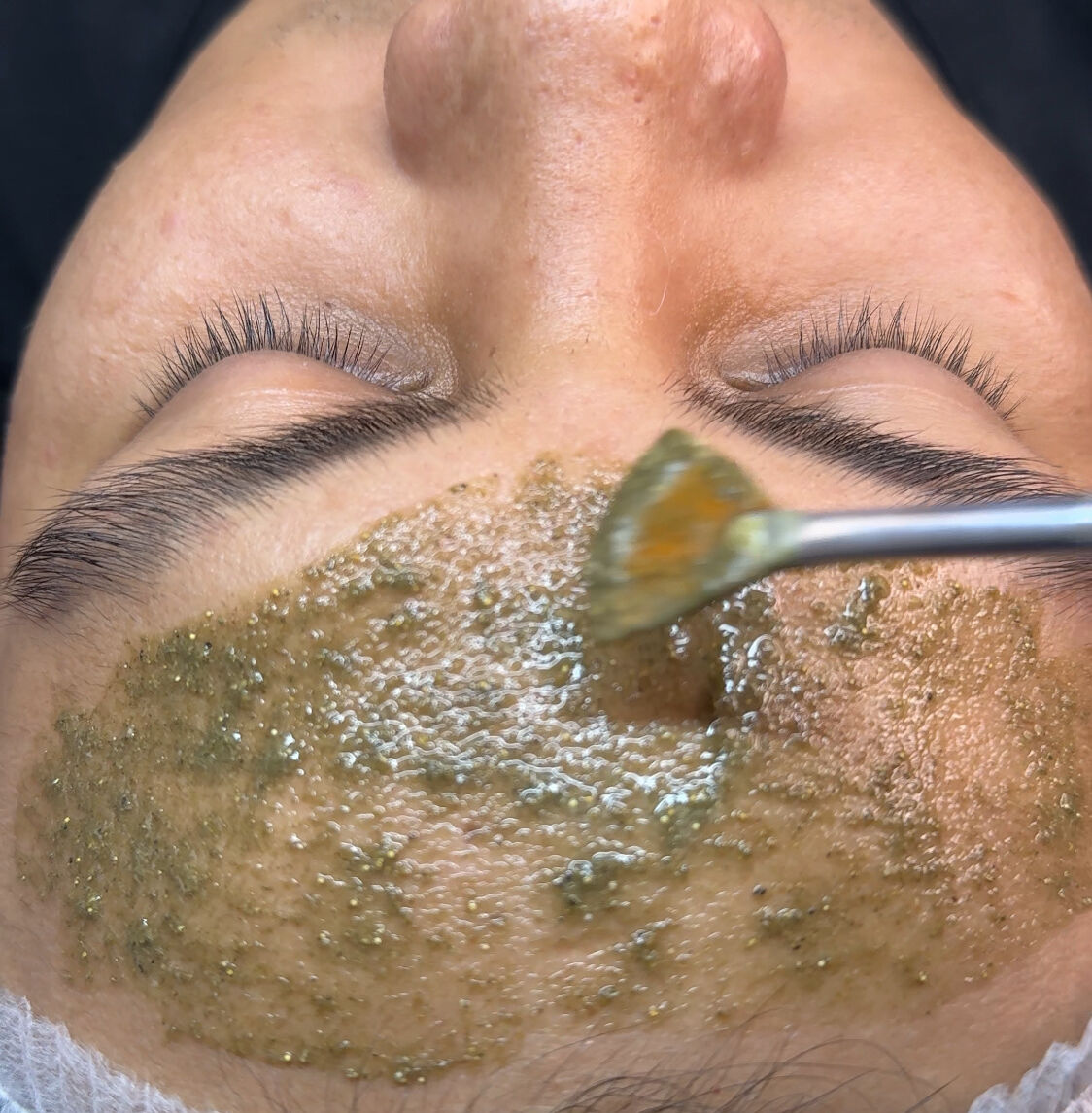 Glow Peel