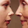 EXOSOMAS: La revolución en rejuvenecimiento facial